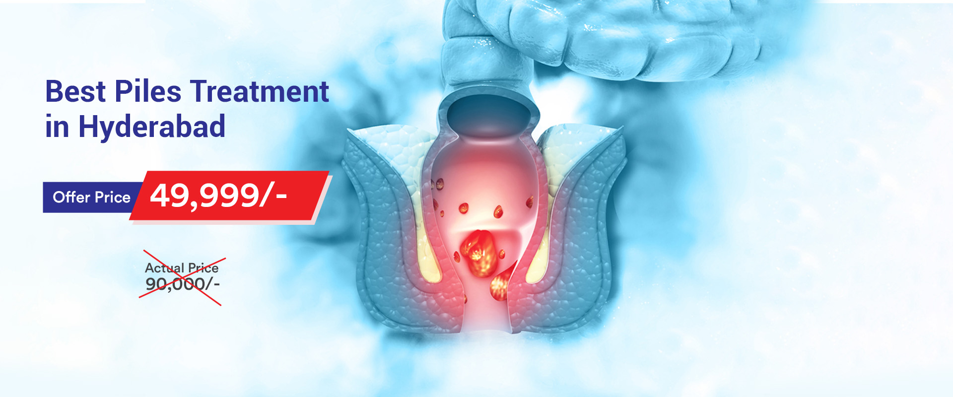 Knee replacement treatment madhapur