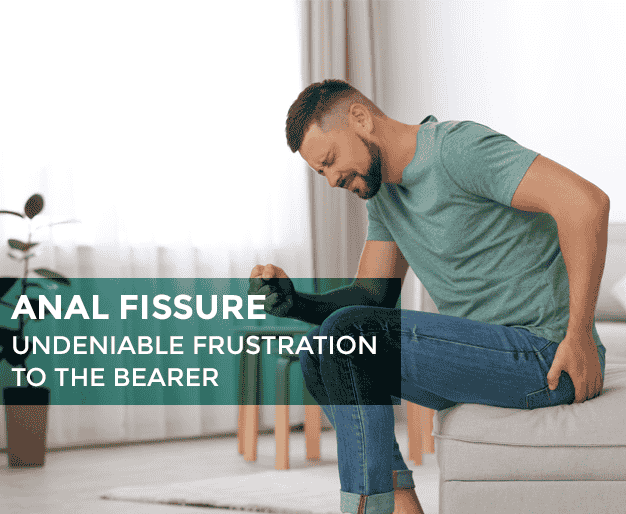  Fissures: Symptoms, Causes, and Treatment 