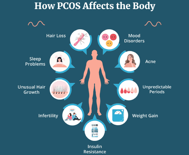 PCOS