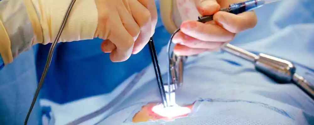 Advanced Laser Proctology Treatment in Madhapur