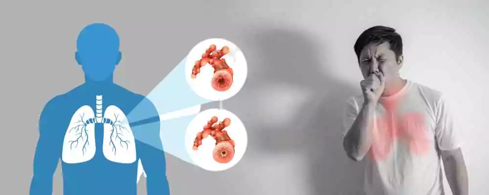 Best Pulmonology Specialist in Madhapur for Lung Care